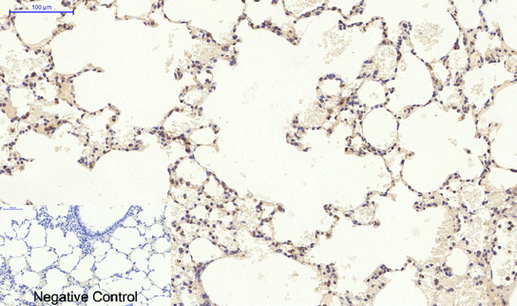IHC - p38 Polyclonal Antibody AP71696
